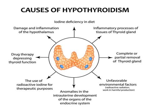 Image result for Hypothyroidism Treatment Algorithm