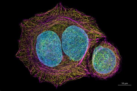 ZEISS Airyscan | Super-resolution imaging and molecular measurements