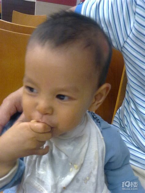 脑膜炎伴吞咽障碍孩子的喂养和护理-幼儿期(1-3岁)-孩爸孩妈聊天室-杭州19楼