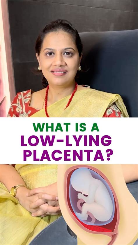 srikrishnaclinic | What is low lying placenta? #apollohospitalschennai #gynaecologist # ...