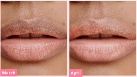 Lip Wash™ for Hydrated Pink lips | Lip Pigmentation & Lipstick Removal ...