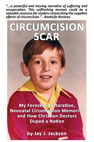 Buy Circumcision : My Foreskin Restoration, Neonatal Circumcision ...