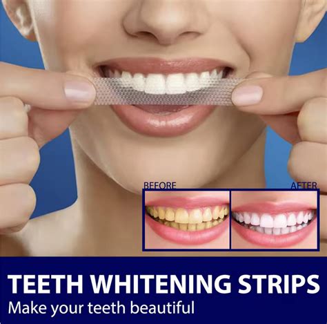 SmileLuxe™ Teeth Whitening Strips – Himalayan Cloud