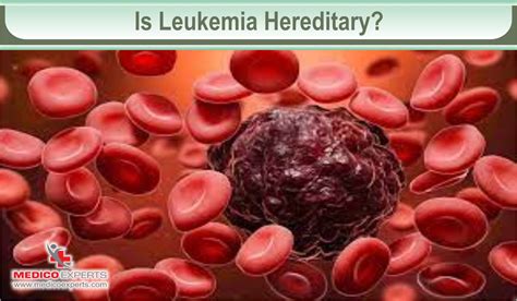Is leukemia hereditary? Understanding genetic links