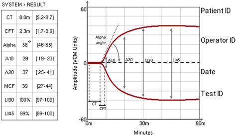 VCM Training 的图像结果