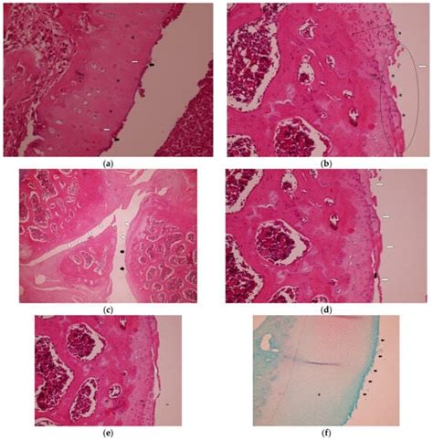 Dual-Compartment Anti-Inflammatory and Chondroprotective Effects of ...