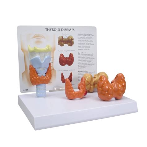 Buy GPI Anatomicals - Thyroid Model Set | Human Body Anatomy Replica of ...