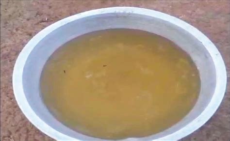 କିଡ୍‌ନି ରୋଗ ନେଲାଣି ୨୦ ଜୀବନ: ଅବହେଳିତ ଗାଁ ବେଣୀପଥର