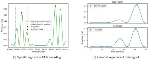 Fog-Computing-Based Heartbeat Detection and Arrhythmia Classification ...