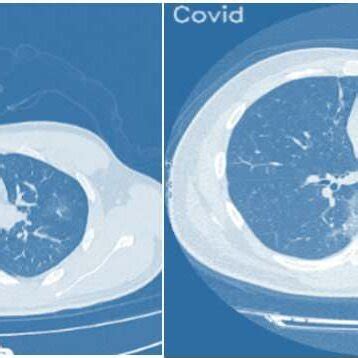 Image result for Binary Classification Model