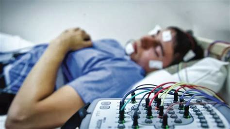 EEG-Guided Anesthesia for Cardiac Surgery fails to Reduce Postoperative ...