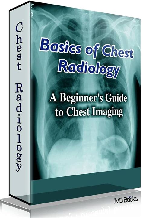 Basics of Chest Radiology - New Edition eBook : Davies (Contributing ...