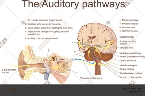 Auditory Feedback System Computer 的图像结果
