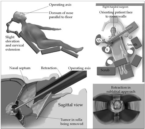 Anesthesia Record Example 的图像结果
