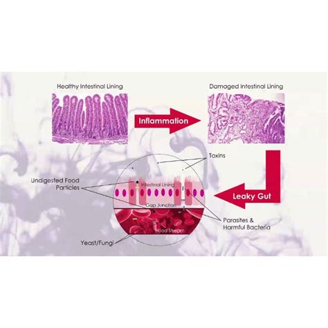 Ayurveda and Auto-Immune Diseases - The Ayurveda Experience - The ...