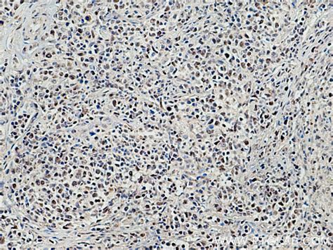 TCOF1 antibody (11003-1-AP) | Proteintech