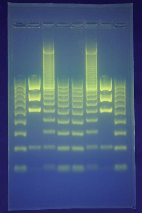 Image result for DNA Fingerprinting Examples