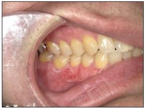 A Case of Application of Computer-Aided Design and Manufacturing ...