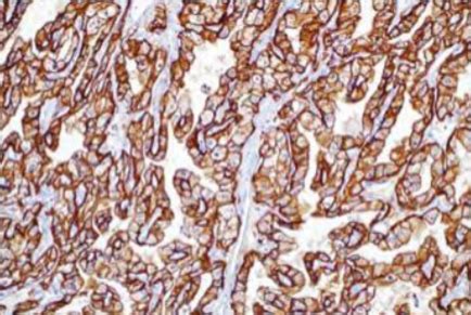 Image result for IHC Staining