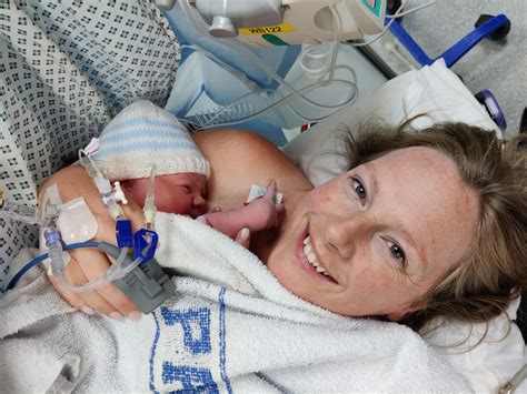 My baby was born without an anus — he's had 6 life-saving surgeries