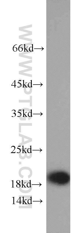 TNFAIP8L2 antibody (15940-1-AP) | Proteintech