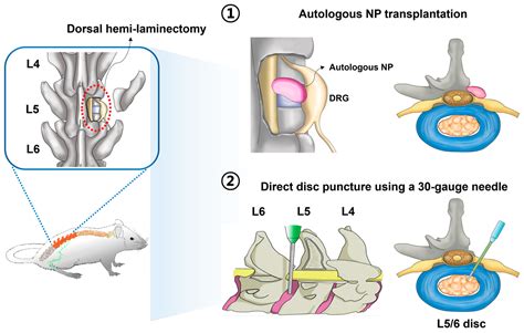 Animal Models of Intervertebral Disc Diseases: Advantages, Limitations ...