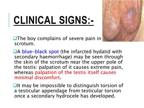 The Acute Scrotum.pptx