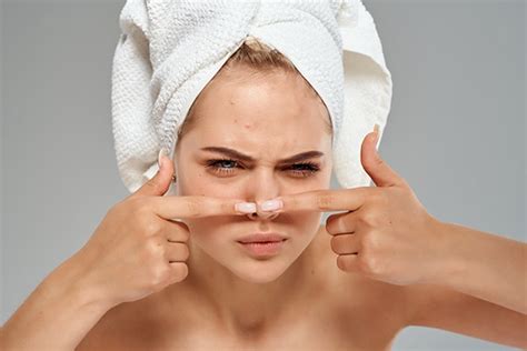 Everything you need to know about triangle of death on face