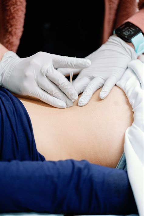 Dry Needling — Texas Pelvic Health