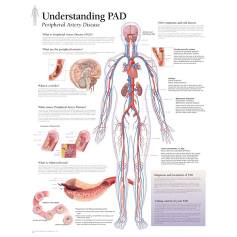 Scientific Publishing Understanding Peripheral Artery Disease Chart