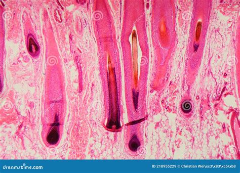 Human Hair Follicle in Skin Under the Microscope Stock Image - Image of ...