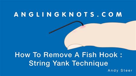 Image result for String Pull Method Fish Hook Removal