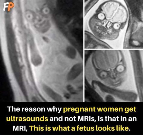 Pregnant woman MRI scan of the Fetus. - Images
