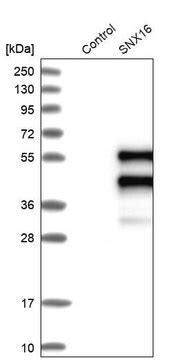 Anti-SNX16 antibody produced in rabbit Prestige Antibodies® Powered by ...