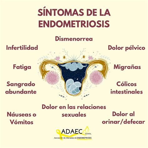 Endometrioma: Qué Es, Síntomas, Causas Y Tratamiento – FZMNG