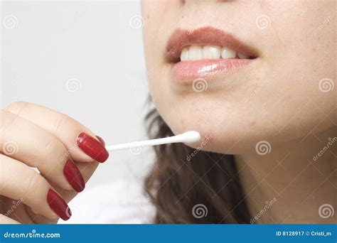 Image result for Loud Exploding Zit