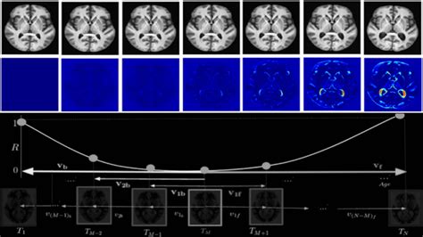 Medical Image Processing @ CVIT, IIIT Hyderabad