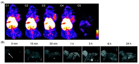 Dual-Mode Tumor Imaging Using Probes That Are Responsive to Hypoxia ...