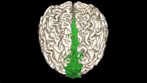 Image result for Storage of Waste Brain Map