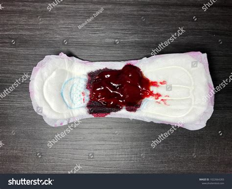 Large Clots During Period