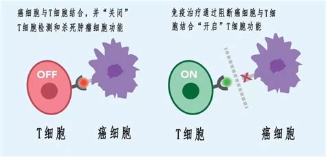 改良版CAR-T成功应用于实体瘤，攻克“癌中之王”不是梦！ - 知乎