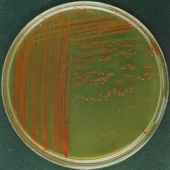 Image result for Enterococcus Faecalis MSA Plate
