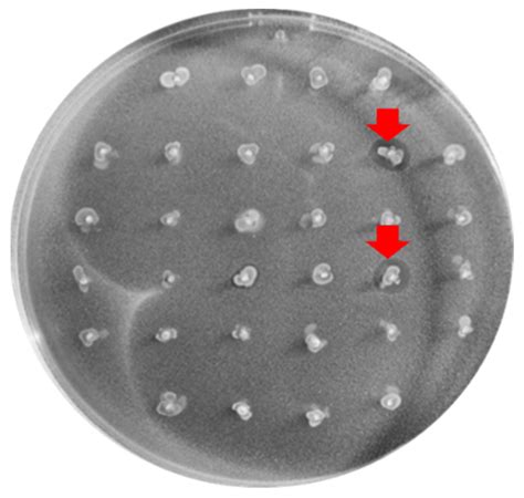 Image result for Enterococcus Chlorination