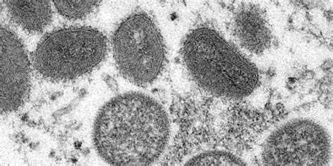 ‘We do not have to panic’: Health officials investigating possible ...