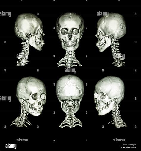 Normal Shape Of Human Skull at Pamela Adkins blog