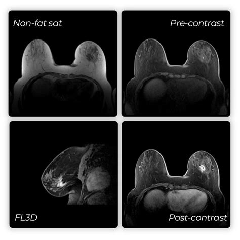 Safe Imaging for Patients with MRI Contraindications - QT Imaging
