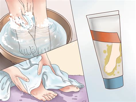 3 Ways to Get Rid of Corns - wikiHow