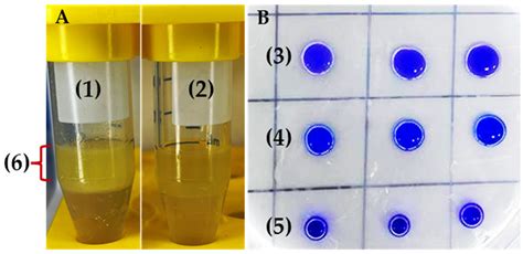 Biotechnological Key Genes of the Rhodococcus erythropolis MGMM8 Genome ...