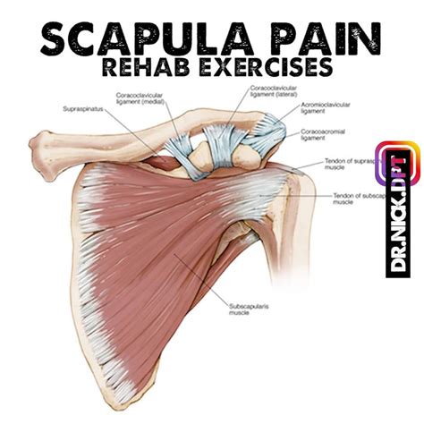 Scapula Pain From Lifting at Alejandra Henning blog