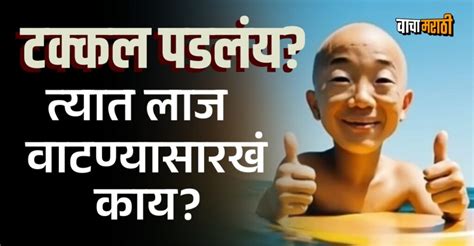 तुम्हाला माहितीये, 'या' देशात टक्कल पडलेल्या लोकांचा क्लब आहे!